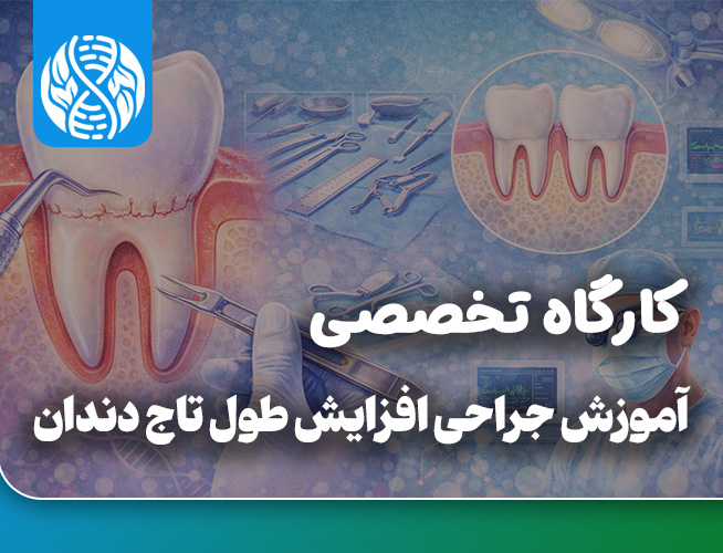 آموزش جراحی افزایش طول تاج دندان